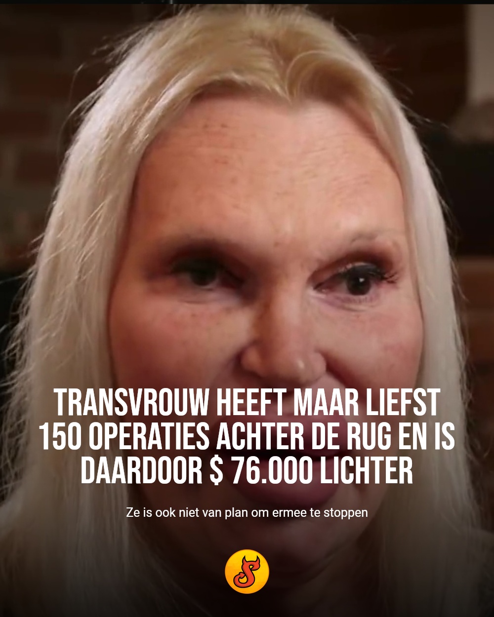 Transvrouw heeft maar liefst 150 operaties achter de rug en is daardoor $ 76.000 lichter