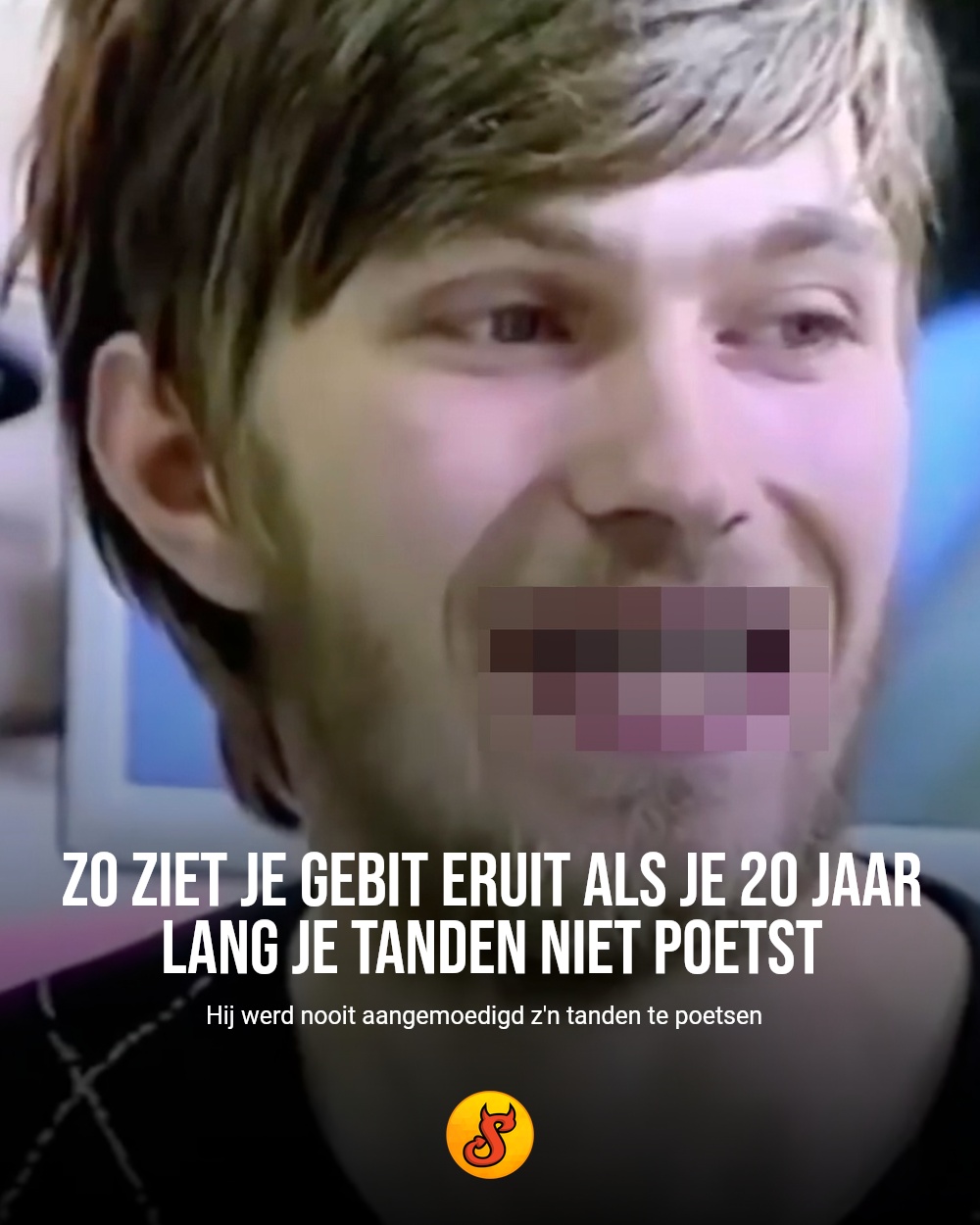 Zo ziet je gebit eruit als je 20 jaar lang je tanden niet poetst
