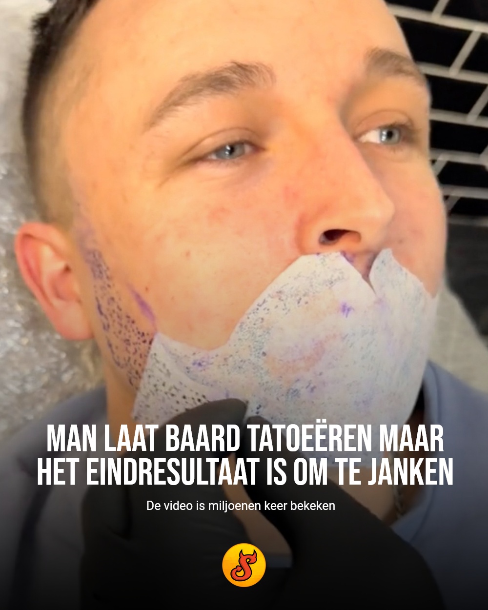 Man laat baard tatoeëren maar het eindresultaat is om te janken