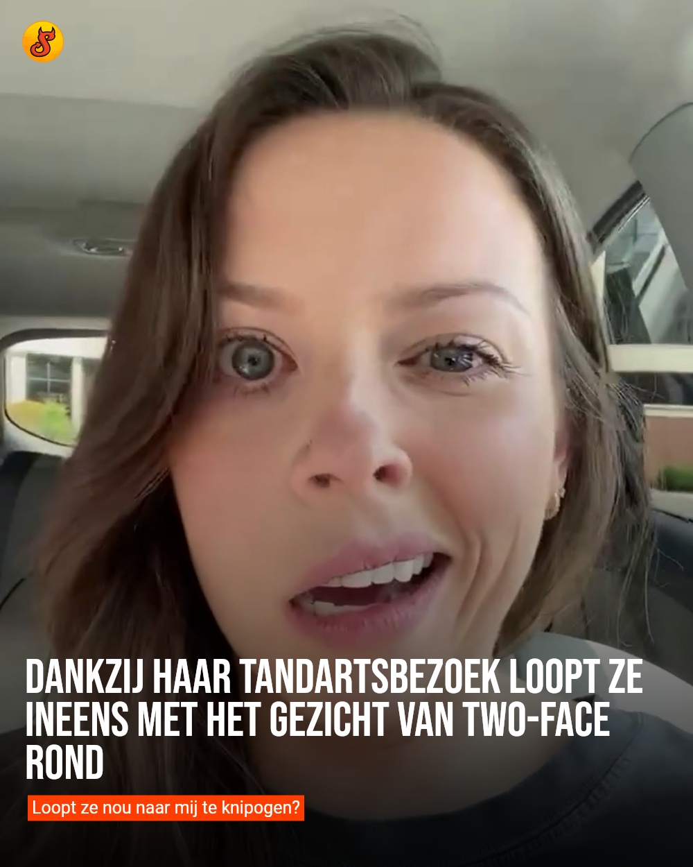 Dankzij haar tandartsbezoek loopt ze ineens met het gezicht van Two-Face rond