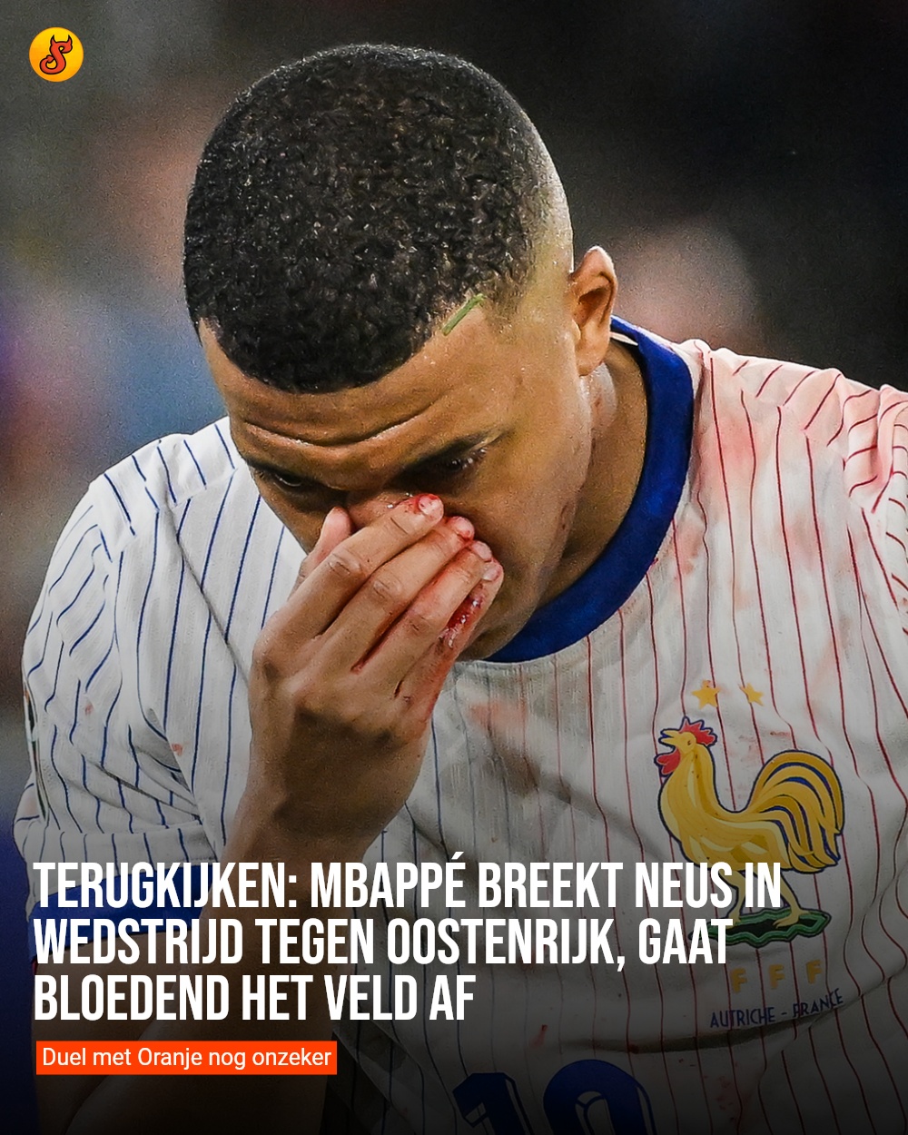 Terugkijken: Mbappé breekt neus in wedstrijd tegen Oostenrijk, gaat bloedend het veld af