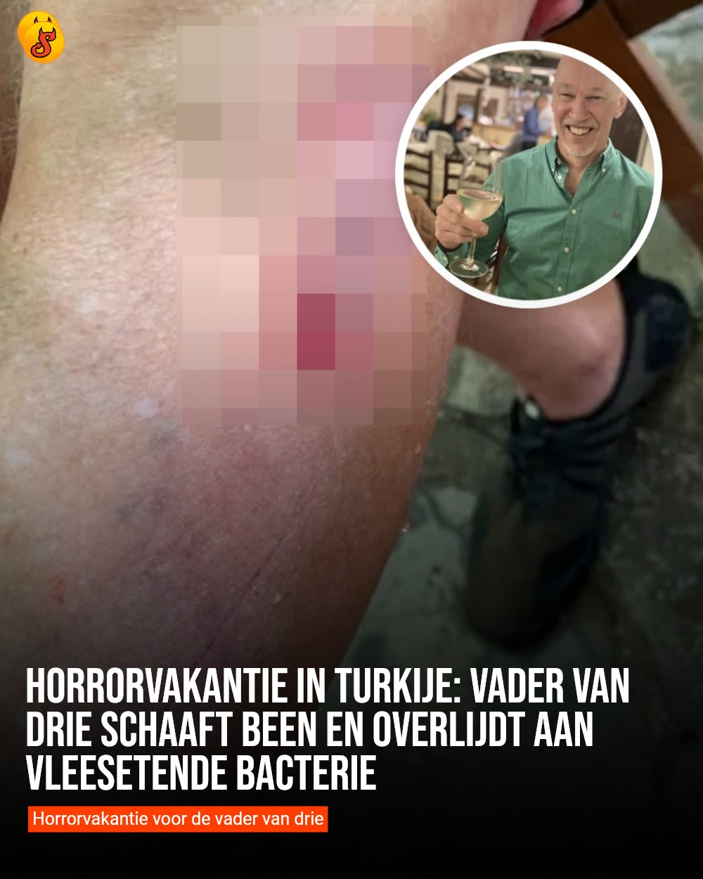 Horrorvakantie in Turkije: Vader van drie schaaft been en overlijdt aan vleesetende bacterie