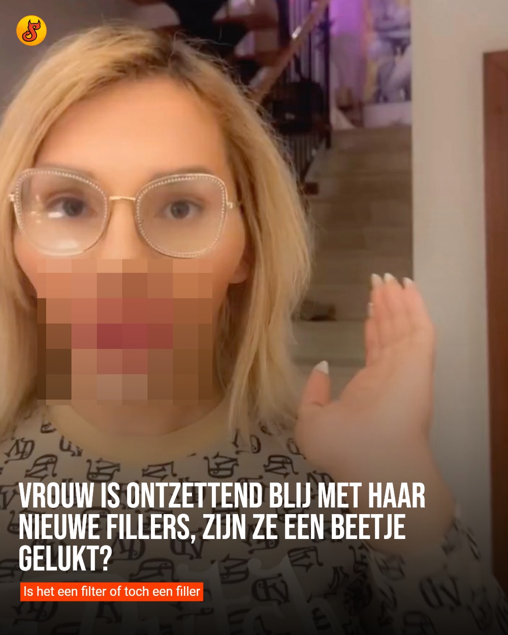 Vrouw is ontzettend blij met haar nieuwe fillers, zijn ze een beetje gelukt?