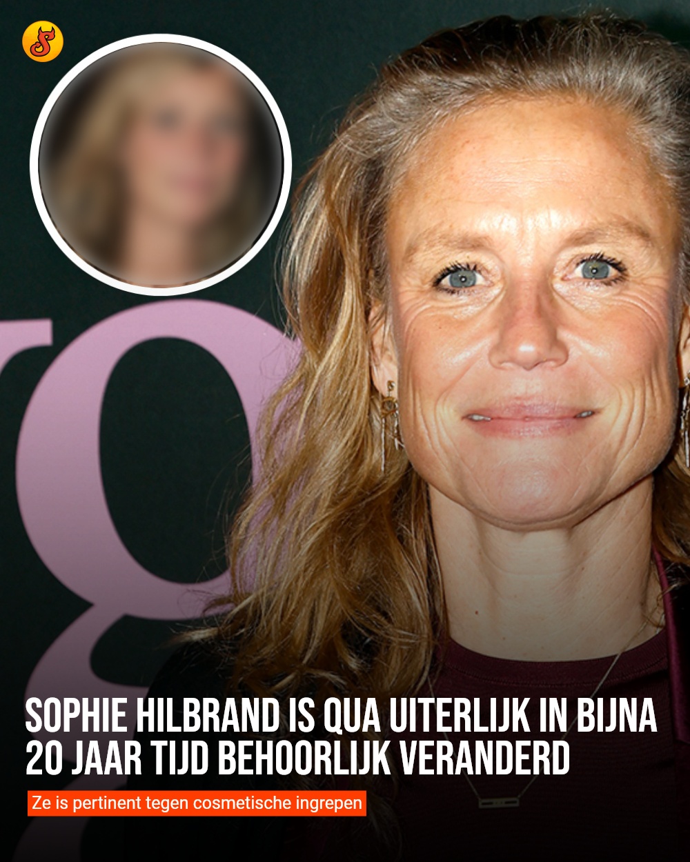 Sophie Hilbrand is qua uiterlijk in bijna 20 jaar tijd behoorlijk veranderd