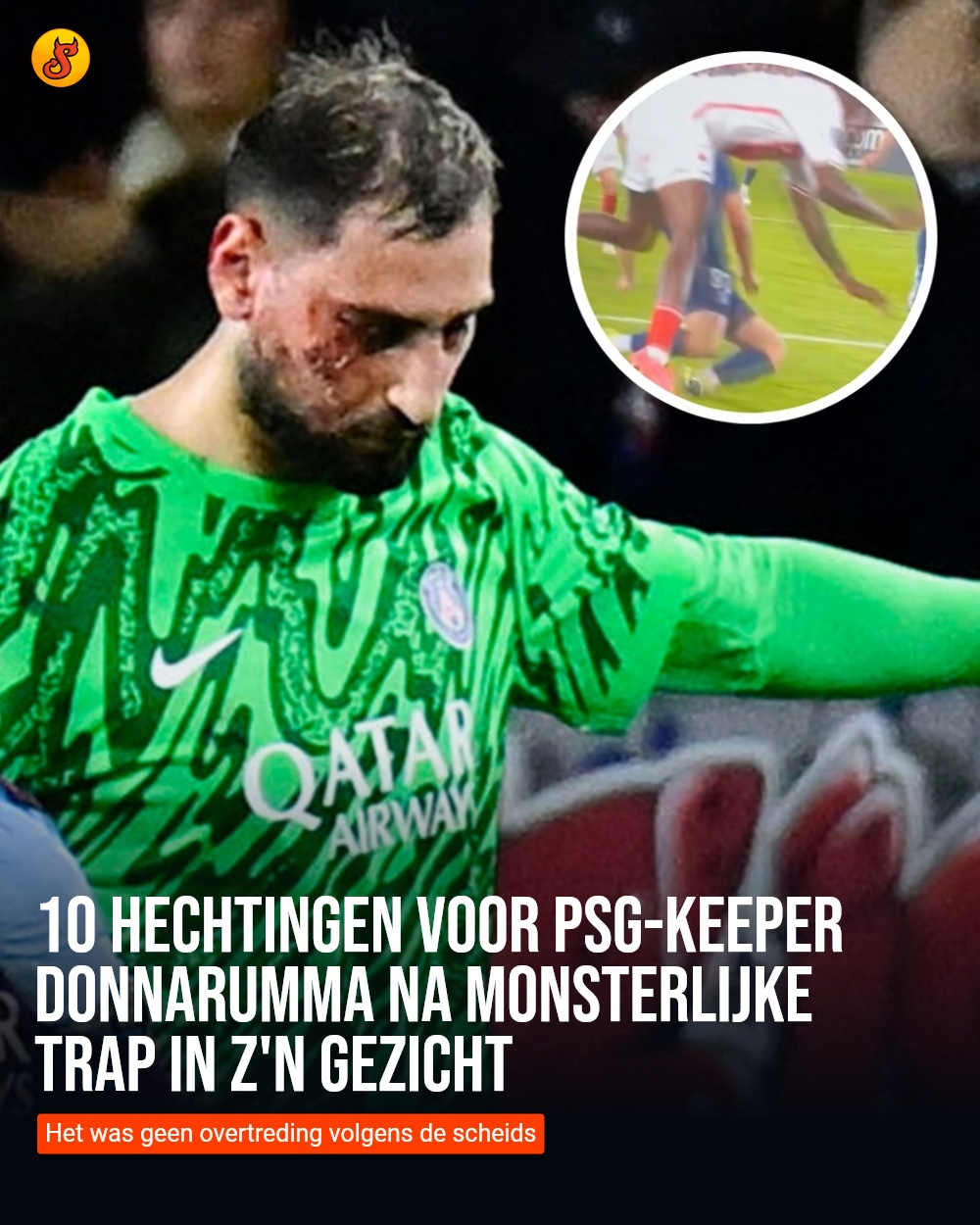 10 hechtingen voor PSG-keeper Donnarumma na monsterlijke trap in z'n gezicht