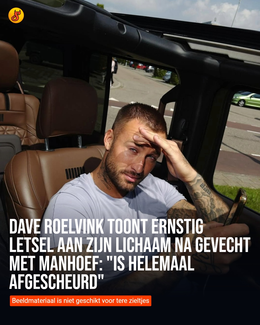 Dave Roelvink toont ernstig letsel aan zijn lichaam na gevecht met Manhoef: "Is helemaal afgescheurd"