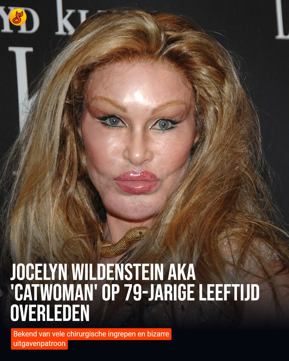 Jocelyn Wildenstein aka 'Catwoman' op 79-jarige leeftijd overleden