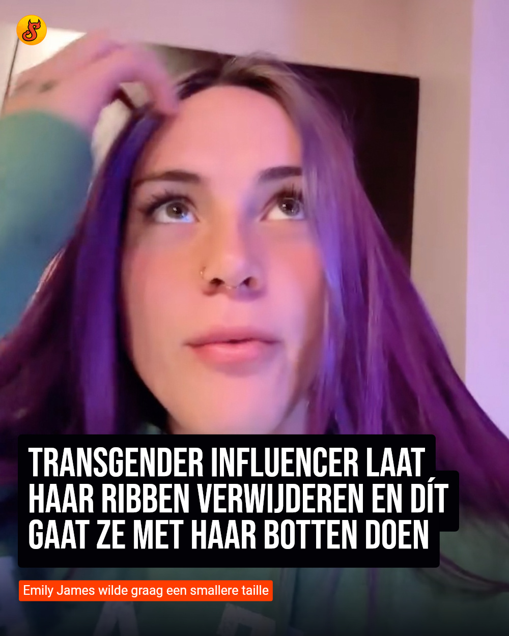 Transgender influencer laat haar ribben verwijderen en dít gaat ze met haar botten doen