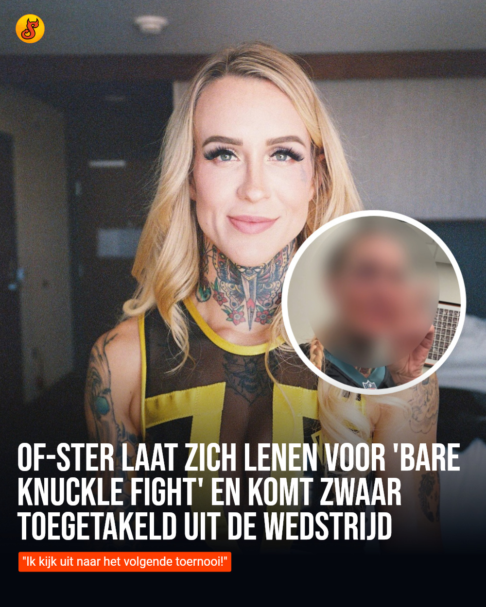 OF-ster laat zich lenen voor 'bare knuckle fight' en komt zwaar toegetakeld uit de wedstrijd