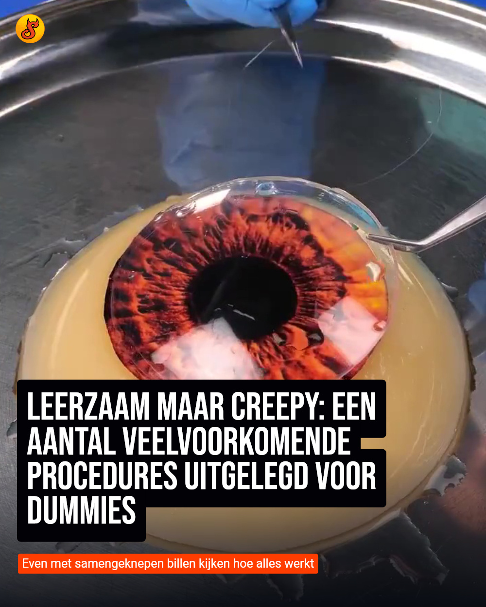 Leerzaam maar creepy: Een aantal veelvoorkomende procedures uitgelegd voor Dummies