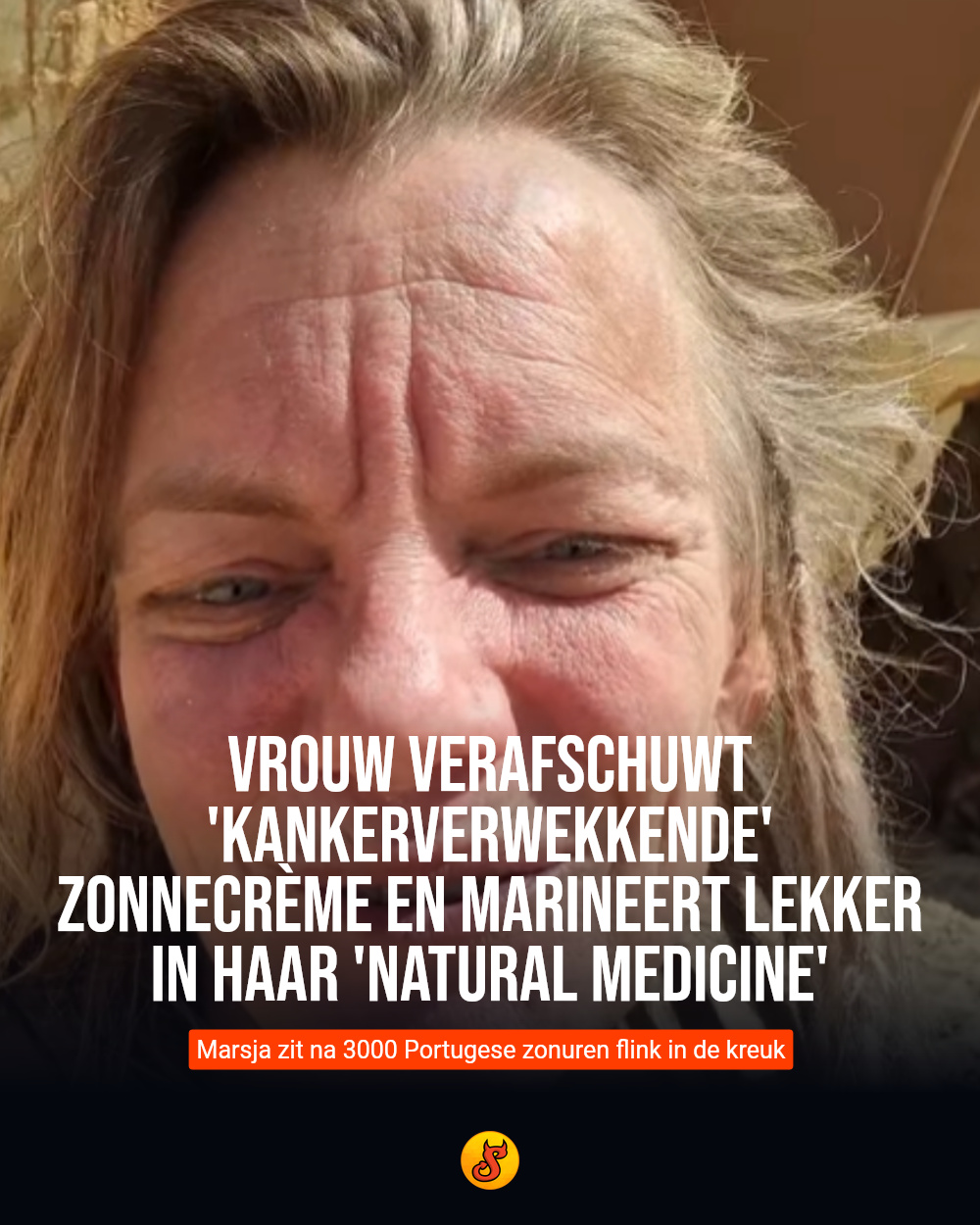 Vrouw verafschuwt 'kankerverwekkende' zonnecrème en marineert lekker in haar 'natural medicine'