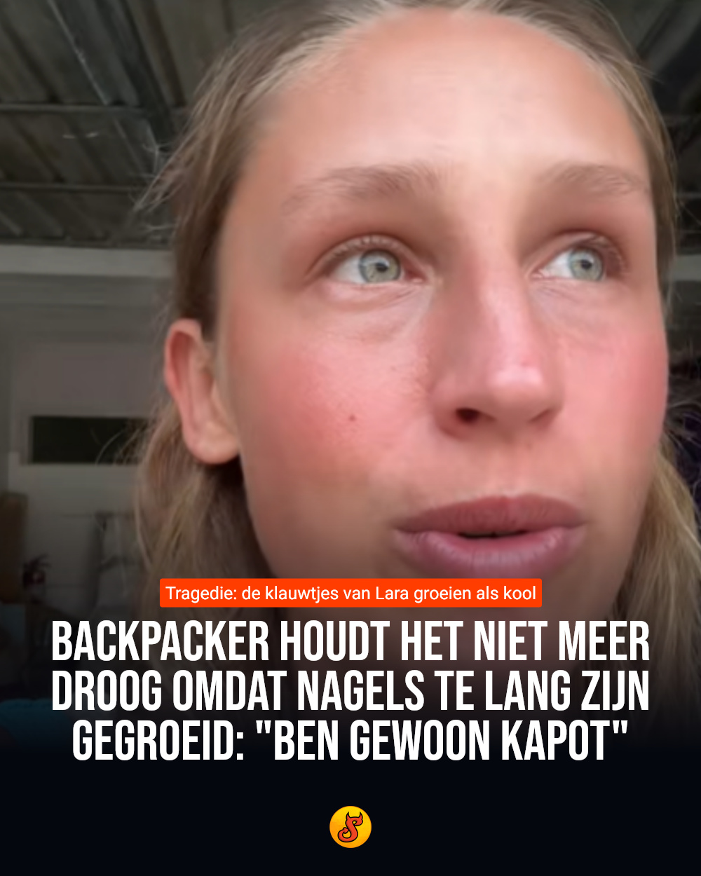 Backpacker houdt het niet meer droog omdat nagels te lang zijn gegroeid: "Ben gewoon kapot"
