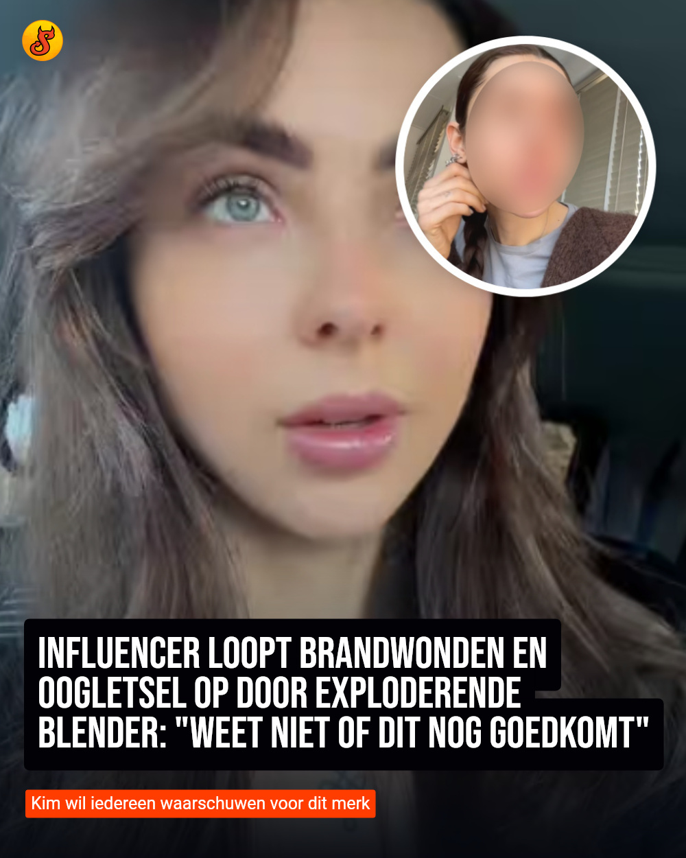 Influencer loopt brandwonden en oogletsel op door exploderende blender: "Weet niet of dit nog goedkomt"
