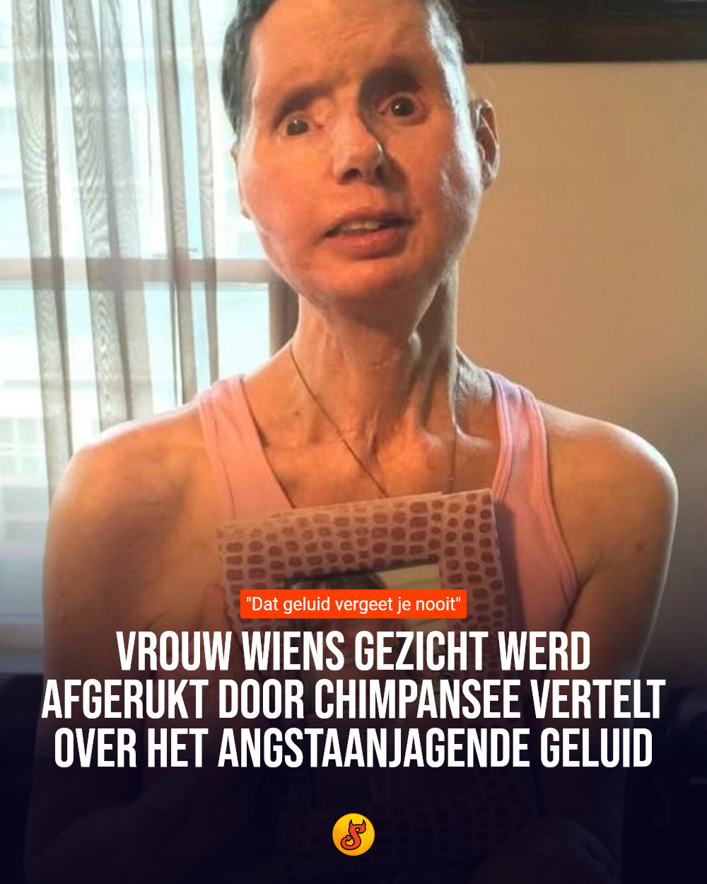 Vrouw wiens gezicht werd afgerukt door chimpansee vertelt over het angstaanjagende geluid