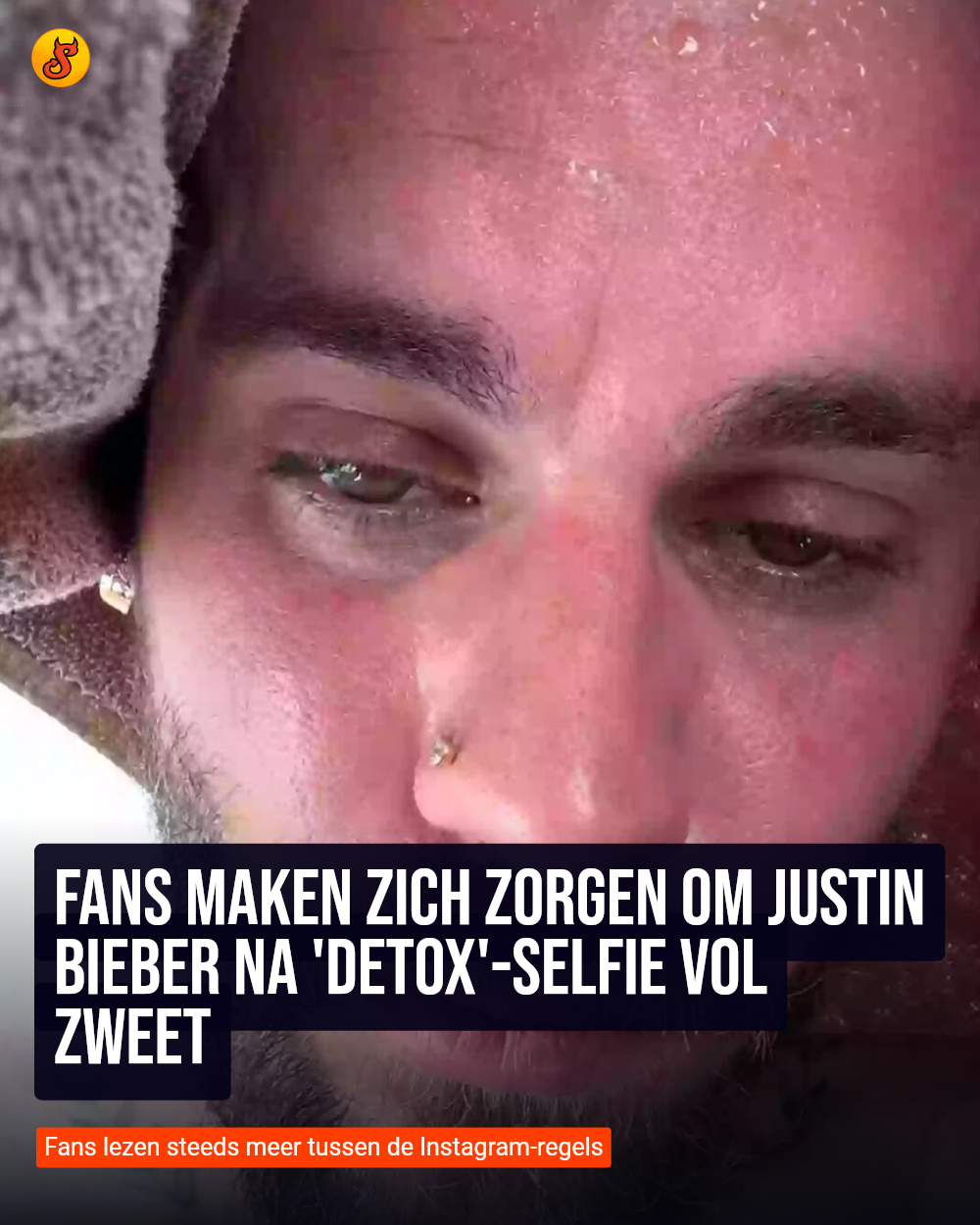 Fans maken zich zorgen om Justin Bieber na 'detox'-selfie vol zweet