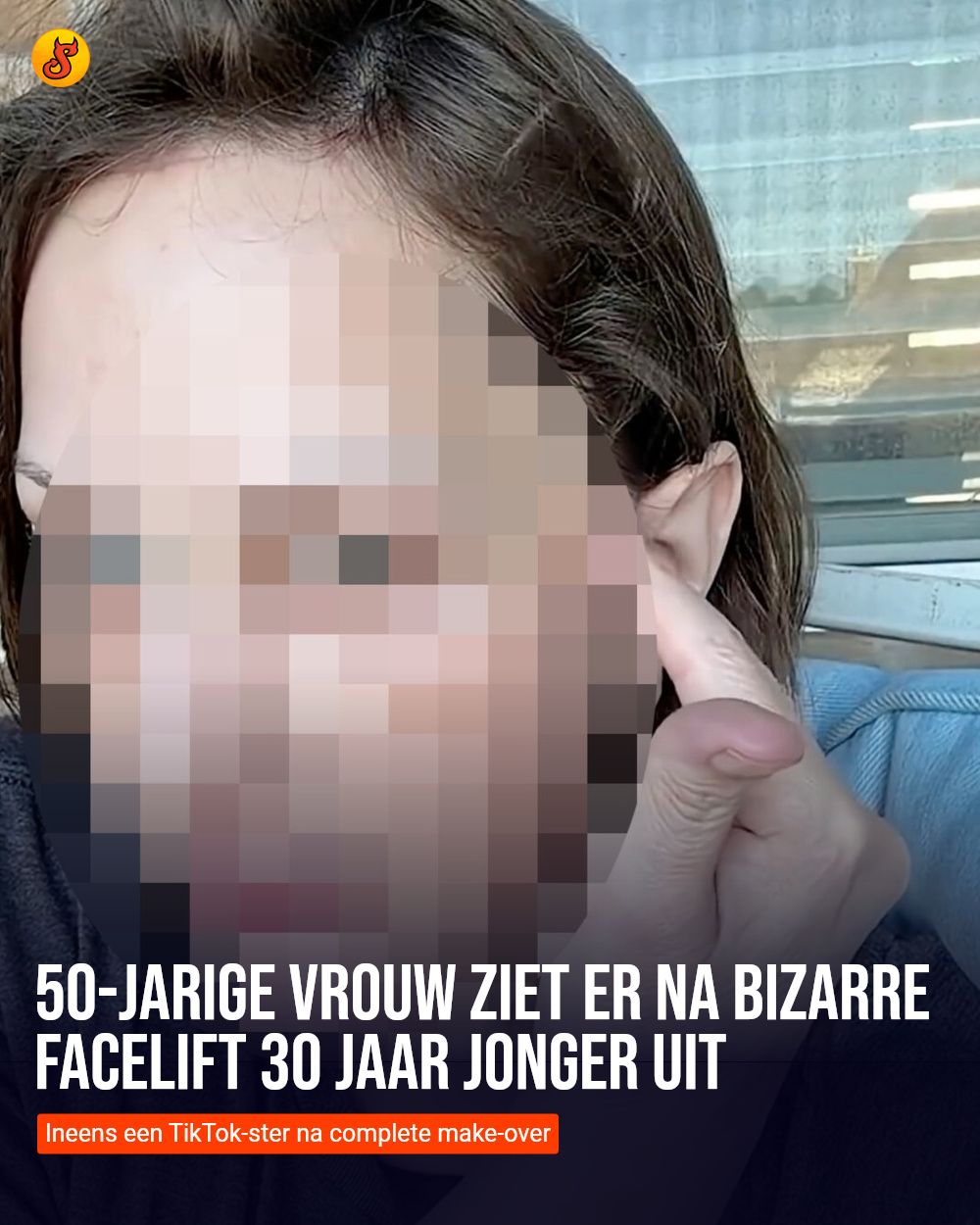 50-jarige vrouw ziet er na bizarre facelift 30 jaar jonger uit