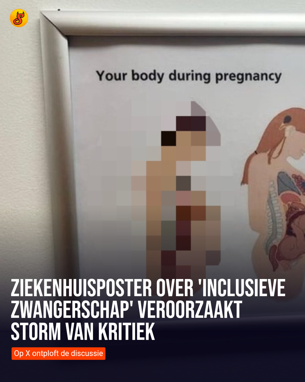 Ziekenhuisposter over 'inclusieve zwangerschap' veroorzaakt storm van kritiek