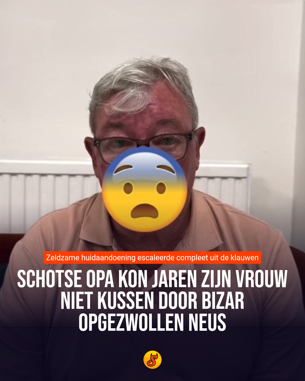 Schotse opa kon jaren zijn vrouw niet kussen door bizar opgezwollen neus
