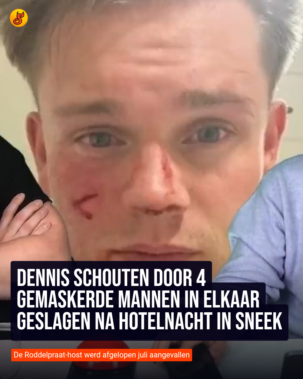 Dennis Schouten door 4 gemaskerde mannen in elkaar geslagen na hotelnacht in Sneek