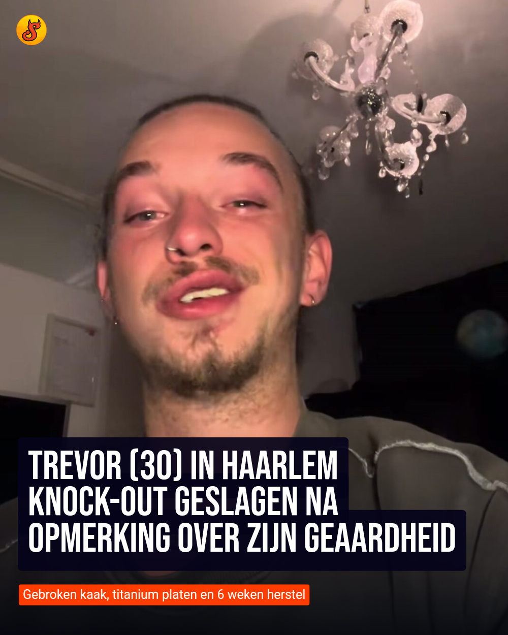 Trevor (30) in Haarlem knock-out geslagen na opmerking over zijn geaardheid