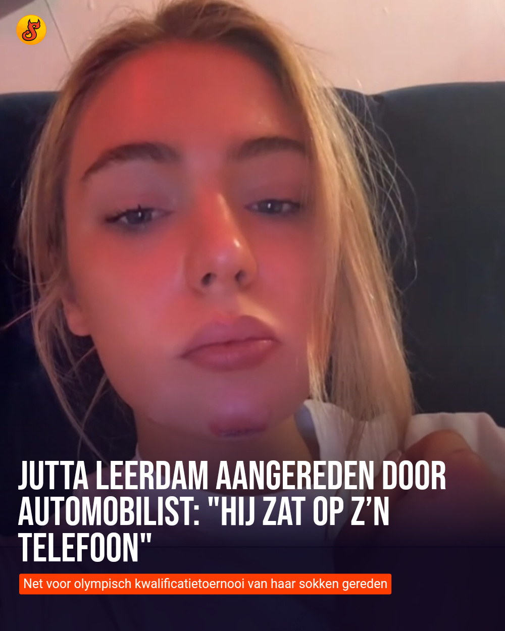 Jutta Leerdam aangereden door automobilist: "Hij zat op z’n telefoon"