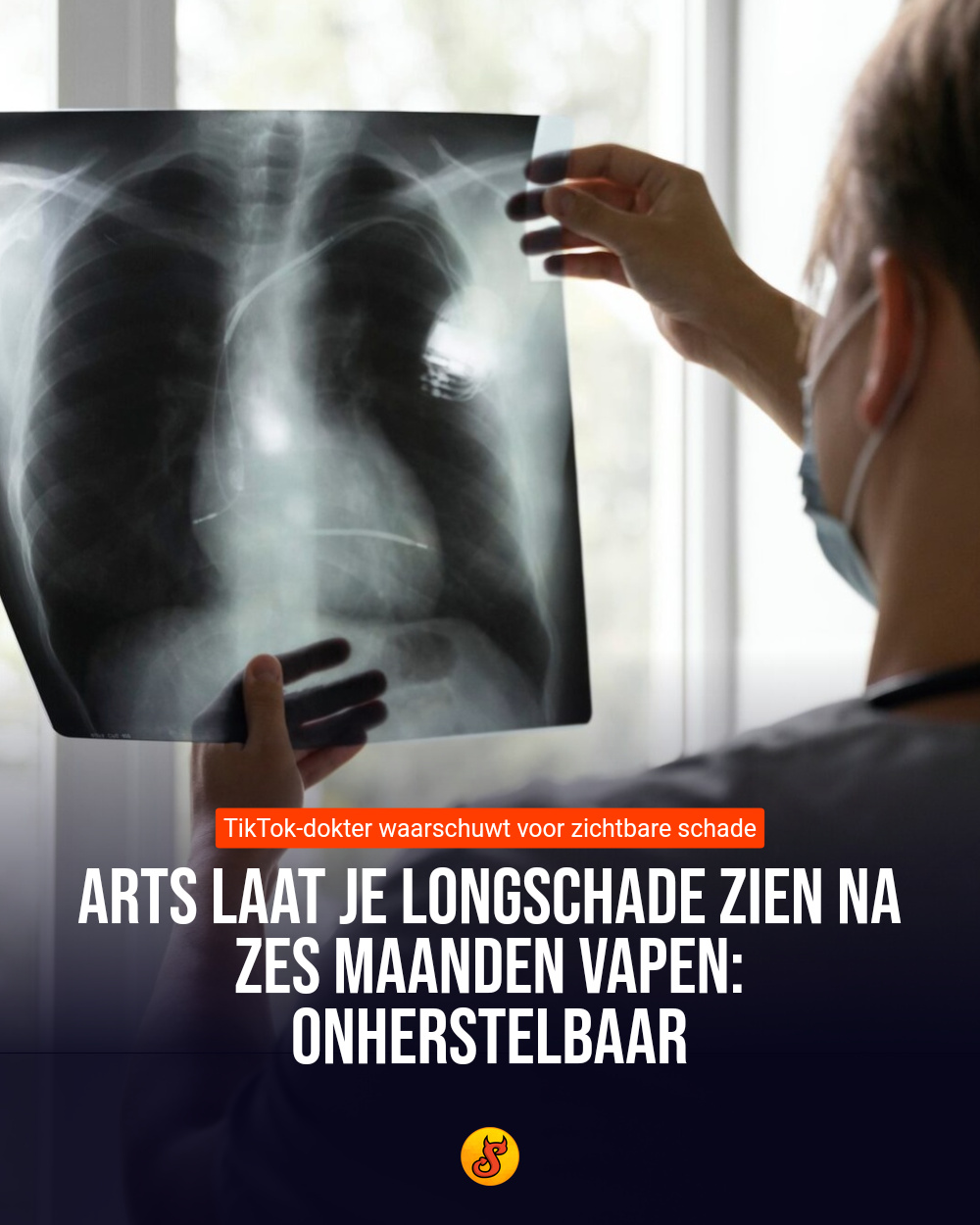 Arts laat je longschade zien na zes maanden vapen: onherstelbaar