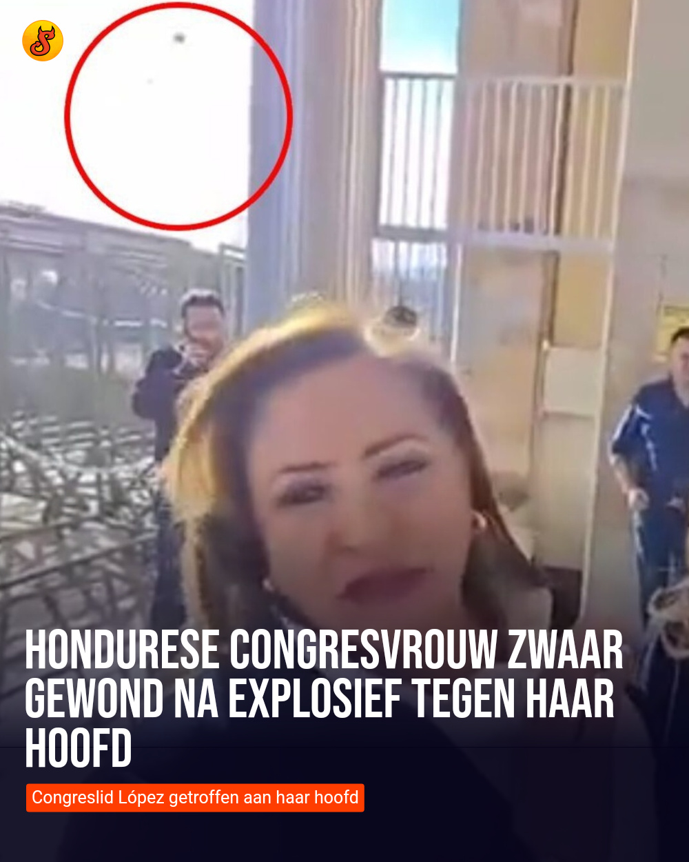 Hondurese congresvrouw zwaar gewond na explosief tegen haar hoofd