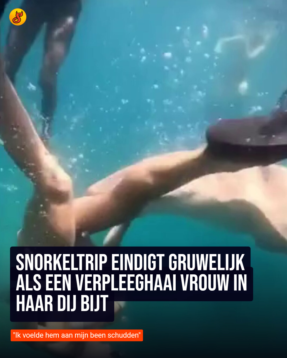 Snorkeltrip eindigt gruwelijk als een verpleeghaai vrouw in haar dij bijt