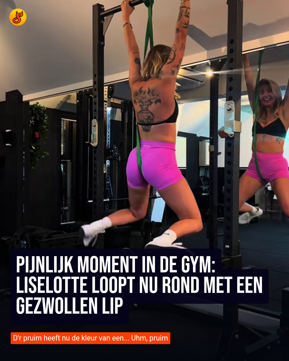 Pijnlijk moment in de gym: Liselotte loopt nu rond met een gezwollen lip