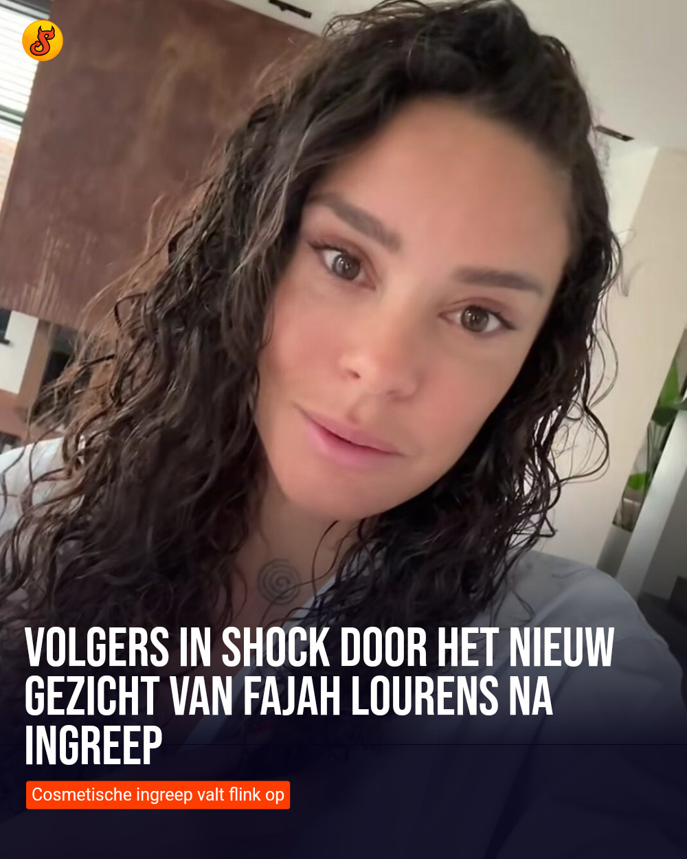 Volgers in shock door het nieuw gezicht van Fajah Lourens na ingreep