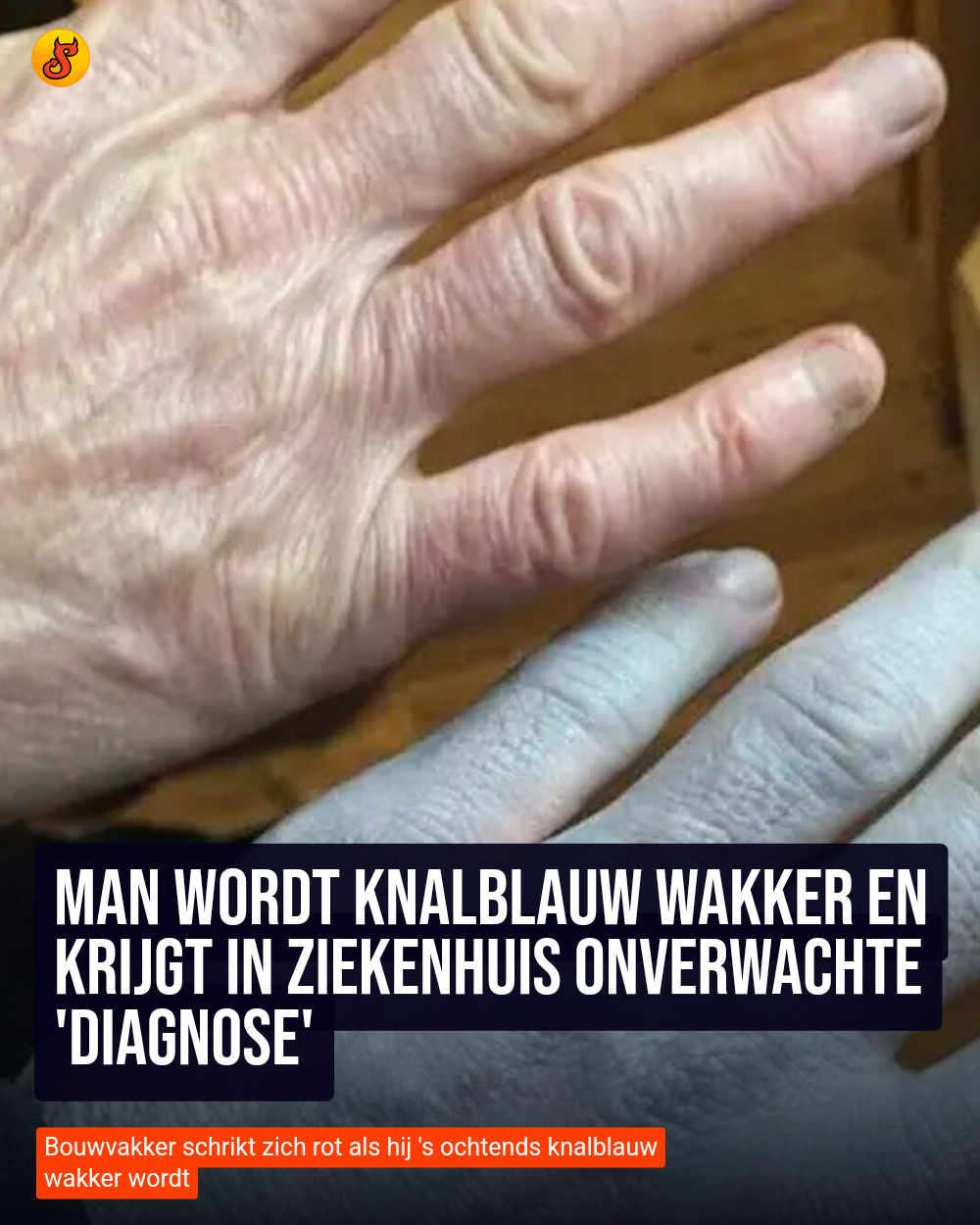Man wordt knalblauw wakker en krijgt in ziekenhuis onverwachte 'diagnose'