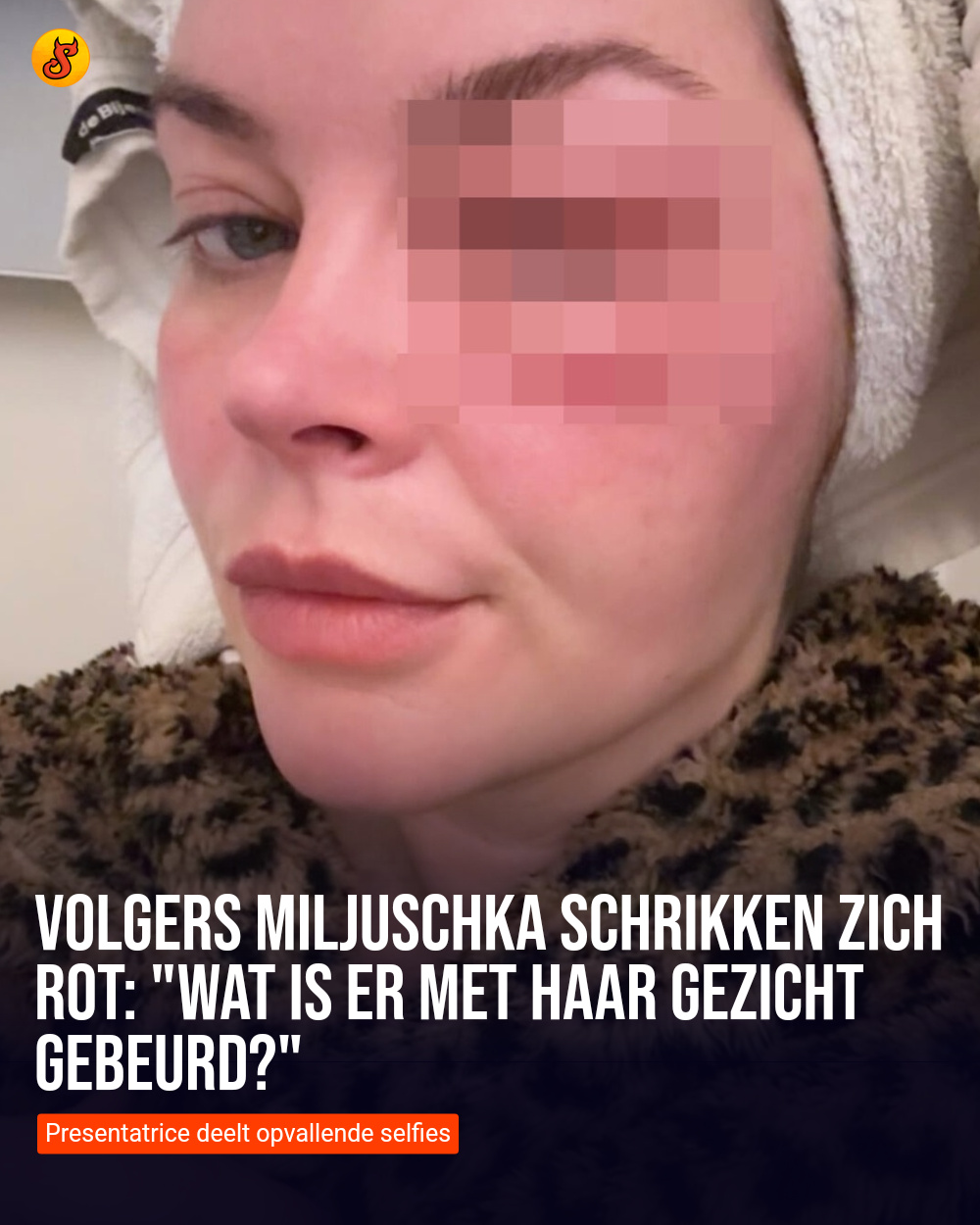 Volgers Miljuschka schrikken zich rot: "Wat is er met haar gezicht gebeurd?"