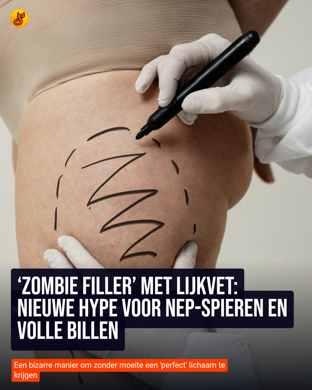 ‘Zombie filler’ met lijkvet: Nieuwe hype voor nep-spieren en volle billen