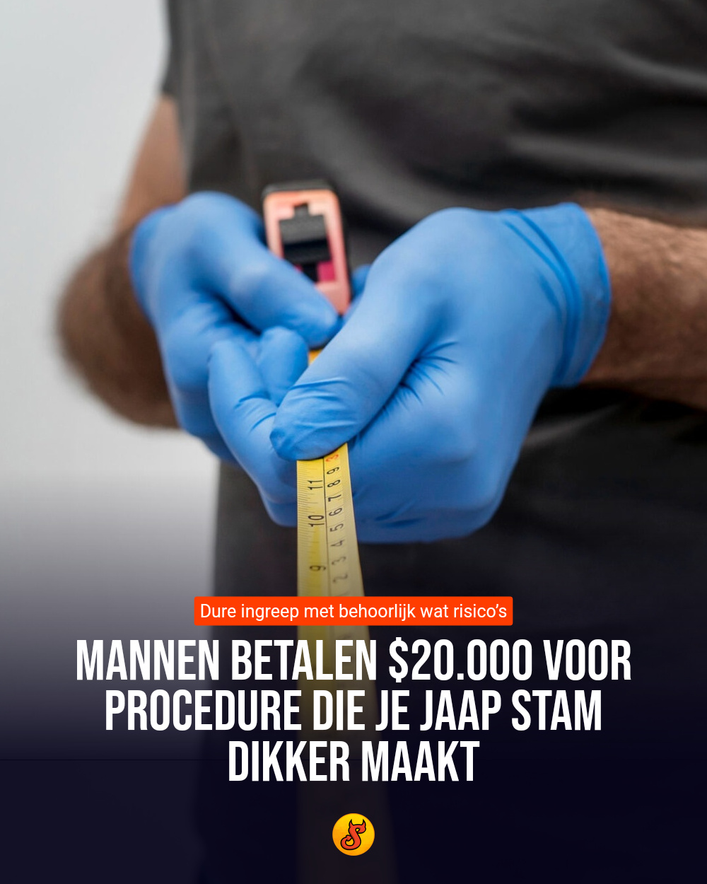 Mannen betalen $20.000 voor procedure die je Jaap Stam dikker maakt