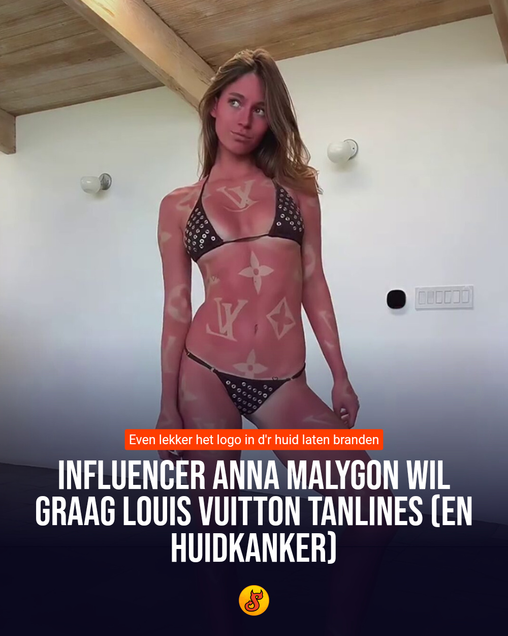 Influencer Anna Malygon wil graag Louis Vuitton tanlines (en huidkanker)