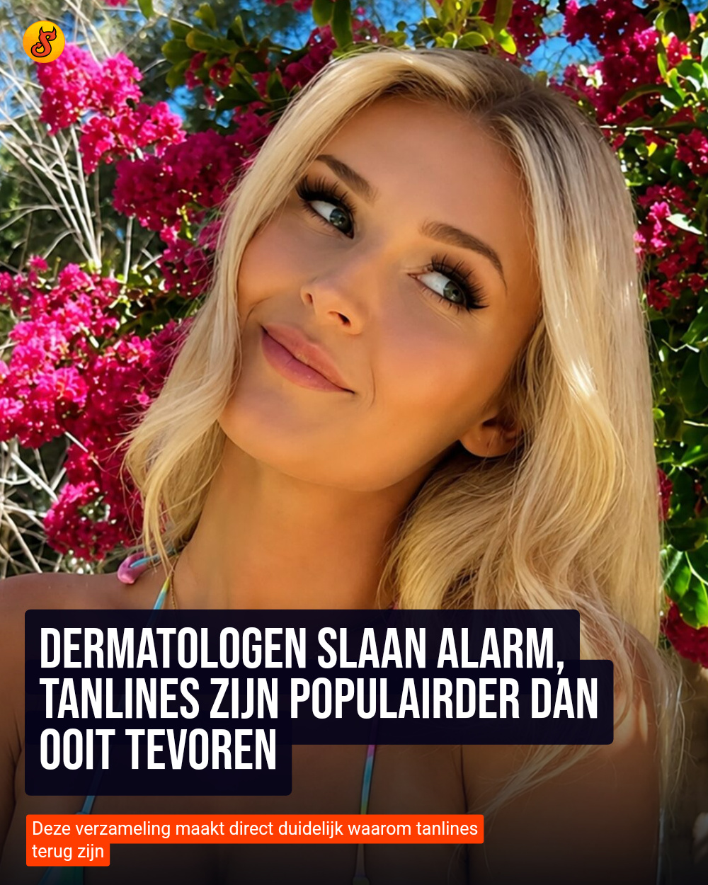 Dermatologen slaan alarm, tanlines zijn populairder dan ooit tevoren