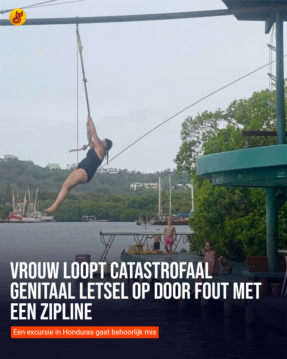 Vrouw loopt catastrofaal genitaal letsel op door fout met een zipline