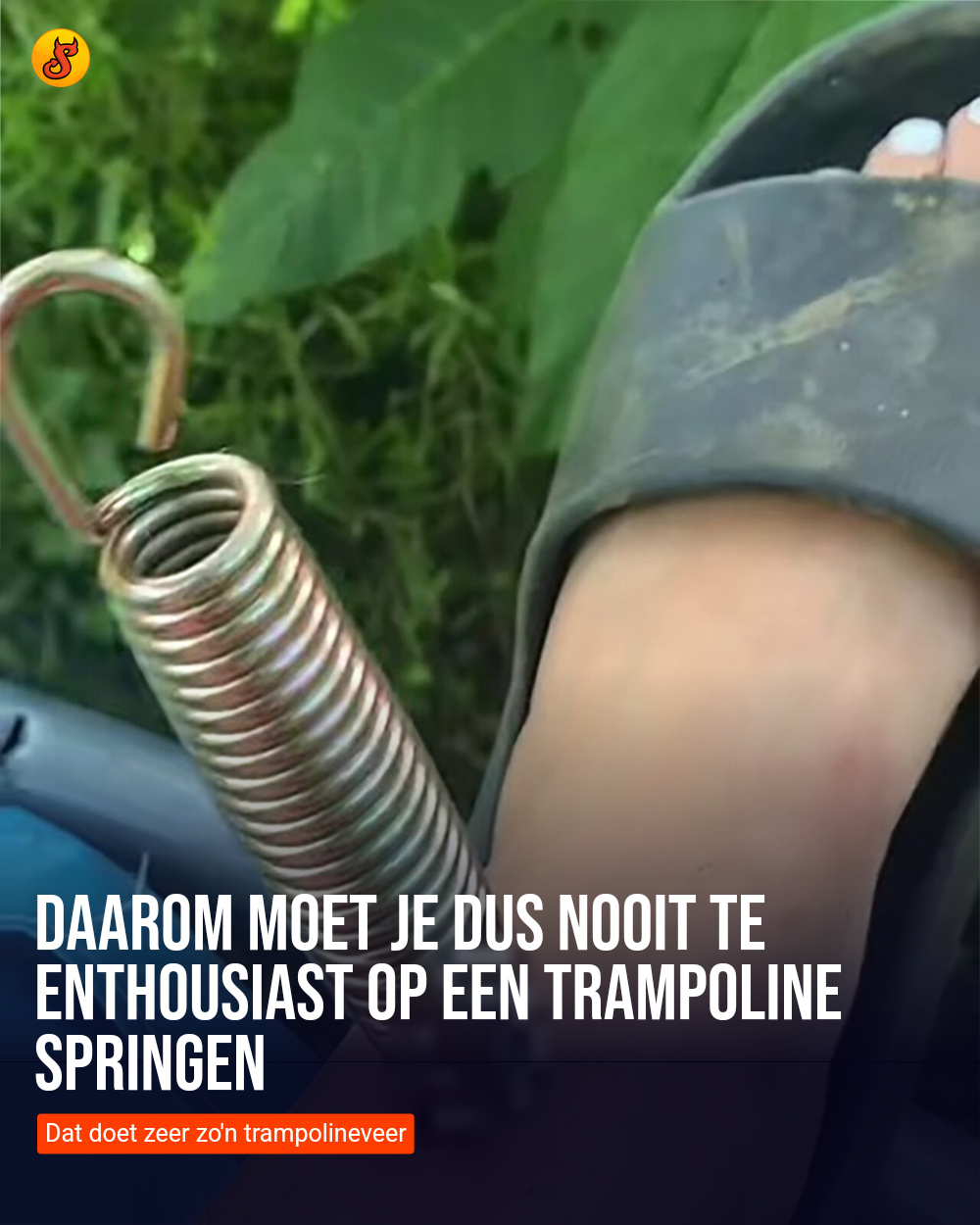Daarom moet je dus nooit te enthousiast op een trampoline springen