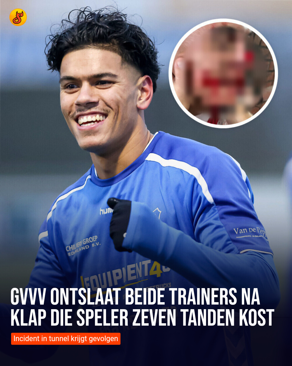 GVVV ontslaat beide trainers na klap die speler zeven tanden kost