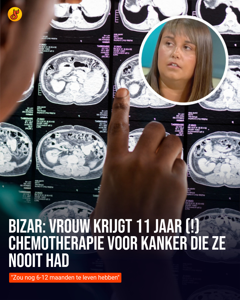 Bizar: Vrouw krijgt 11 jaar (!) chemotherapie voor kanker die ze nooit had