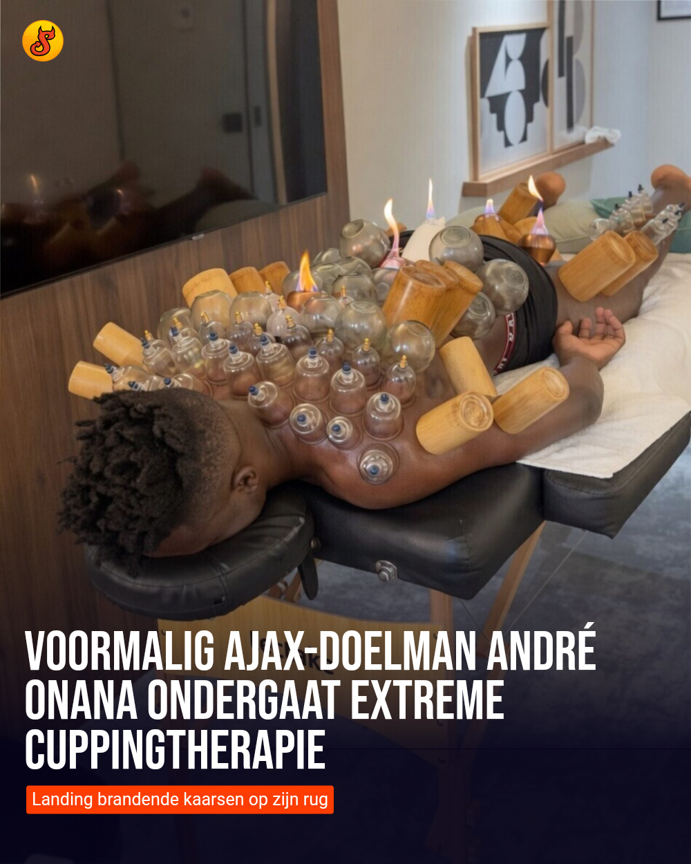 Voormalig Ajax-doelman André Onana ondergaat extreme cuppingtherapie
