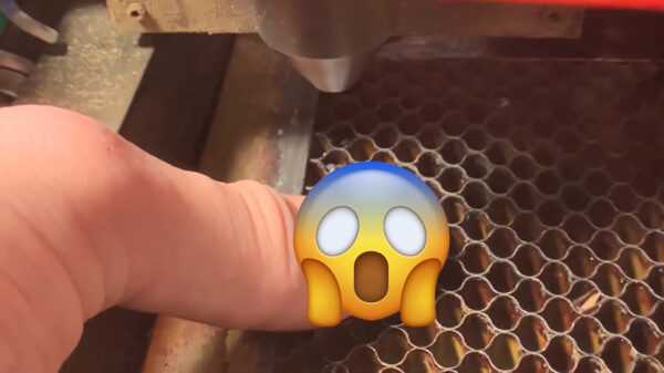 Dit is hoe je letterlijk het bloed onder je nagels vandaan haalt