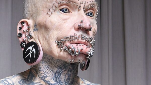 Record: Rolf Buchholz heeft meeste lichaamsaanpassingen ter wereld