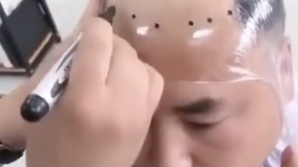 Dankzij deze techniek ben je nooit meer kaal!