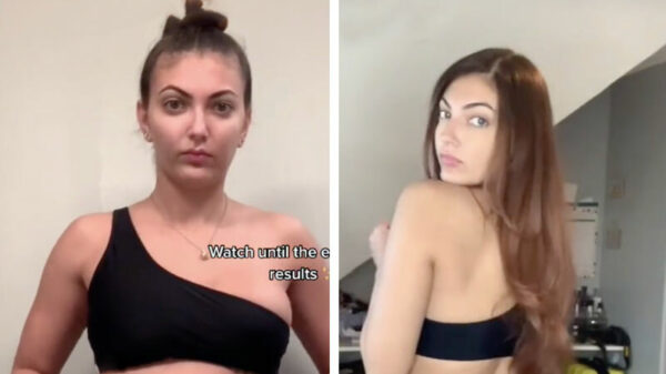 Is deze $5,000 kostende BBL-operatie nou echt de moeite waard?