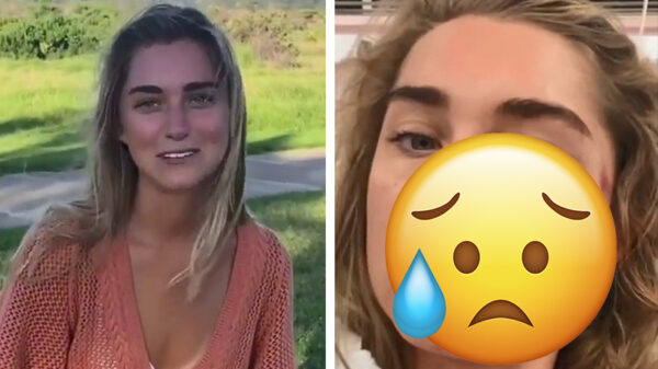 Blonde skateboarder komt erachter waarom je een helm moet dragen