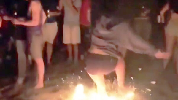 Vuursprongetje eindigt in flink verbrande voetzolen