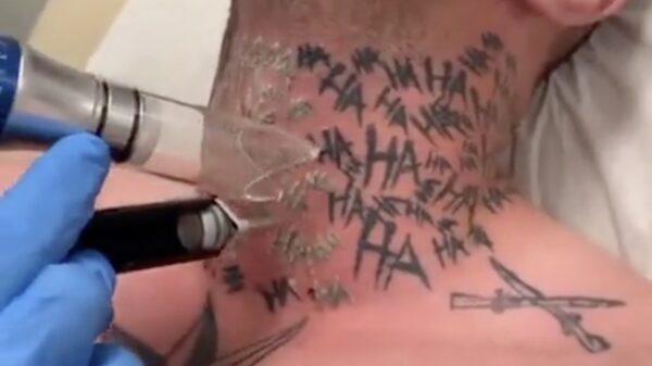 Als je tatoeage in de praktijk toch niet heel grappig blijkt te zijn