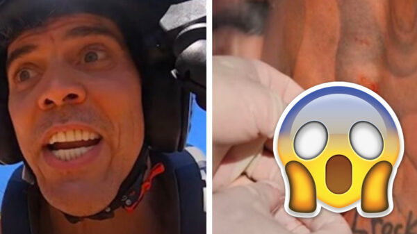 Steve-O nog steeds compleet geschift en laat zich verlammen voor Jackass-stunt
