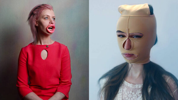 Wie mooi wil zijn moet pijn lijden óf er als een achterlijke bijlopen